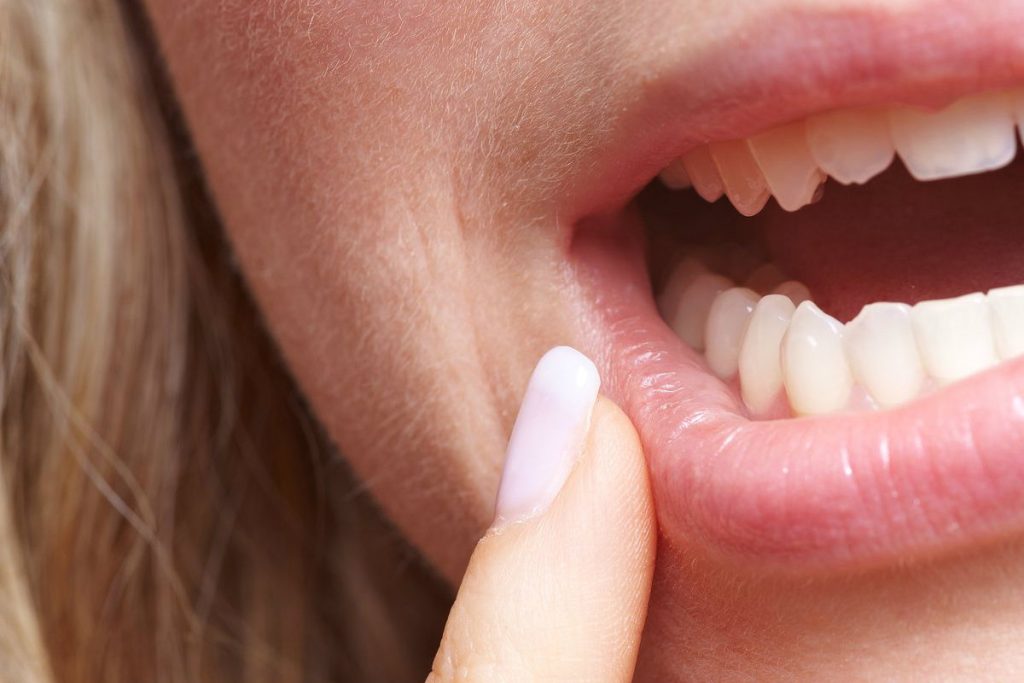 Алое за устната хигиена - гарантира здрави зъби и венци