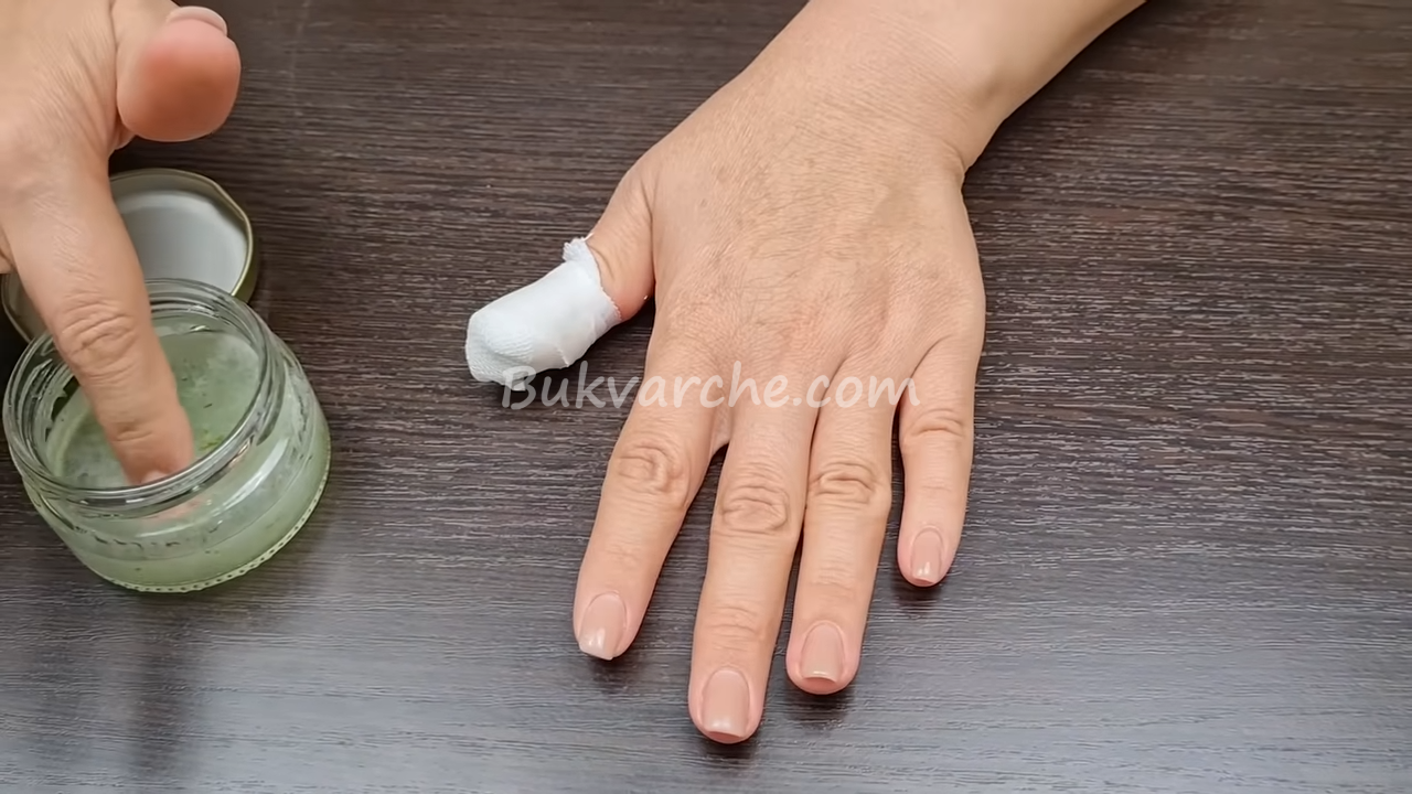 Домашен лек срещу гъбички по ноктите (4)